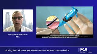 Closing TAVI with next generation suture mediated closure device  PCR London Valves 2021 [upl. by Lsil]