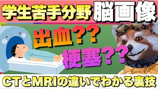 【脳画像】CTとMRIの違いで脳出血か脳梗塞がわかる⁇【看護師国家試験】【PT・OT国家試験】 [upl. by Giefer]