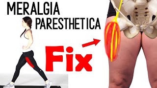 Meralgia paresthetica  upper leg pain  upper thigh pain [upl. by Notnats]