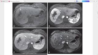 FUNDAMENTALS OF BODY MRI [upl. by Swirsky]