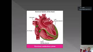 Junctional Tachycardia លោកវេជ្ជ សយ សារៈ [upl. by Asinla]