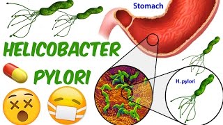 Helicobacter pylori GERMS EATING UP YOUR TUMMY [upl. by Ahselrac]