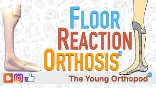 Floor Reaction Orthosis FRO [upl. by Leonardo]