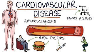 Understanding Cardiovascular Disease Visual Explanation for Students [upl. by Francklyn]