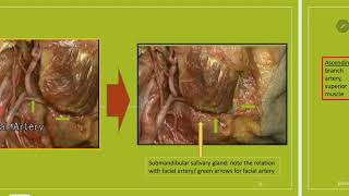 Digastric triangle 3facial arteryamplingual nerve [upl. by Vanda]