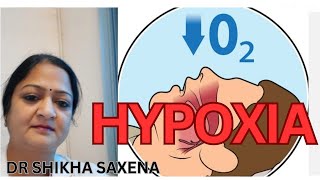 Hypoxic Classification of Hypoxia Telegram httpstmedrshikhasaxenahumanphysiology [upl. by Stortz]