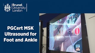 PGCert Musculoskeletal Ultrasound for Foot and Ankle Course [upl. by Emirak]