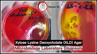 Xylose Lysine Deoxycholate XLD Agar Principle Uses Composition Preparation amp Colony Morphology [upl. by Yrem437]