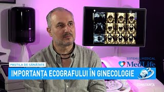 Importanța ecografului în ginecologie explicată de Dr Răzvan Stanca [upl. by Ahtan]