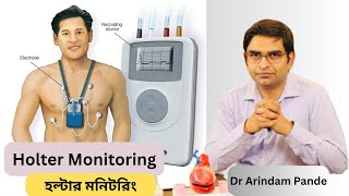 হল্টার মনিটরিং I Holter Monitoring Different types When needed What it detects  Dr Arindam Pande [upl. by Aiza723]