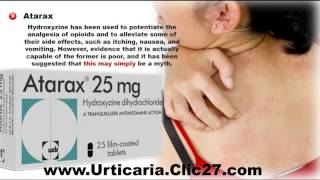 Best Antihistamine For Hives  Best Antihistamine For Urticaria [upl. by Lark]