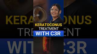 Live Keratoconus Treatment With C3R [upl. by Groves]