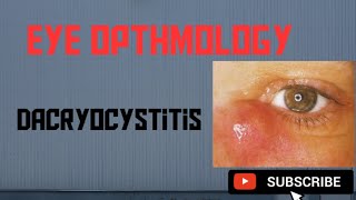 Dacryocystitis  Causes Symptoms Treatment [upl. by Adar]