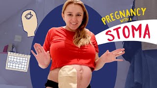 Pregnancy Vs Stoma my experience pregnant with an ileostomy [upl. by Cilla908]