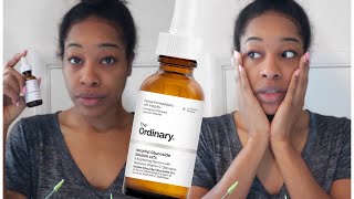 THE ORDINARY VITAMIN C  ASCORBYL GLUCOSIDE  BRIGHTENING SERUM  APPLYING TO SKIN  REVIEW [upl. by Arv]