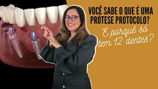 O que é prótese protocolo Adornare Odontologia Estética em Santos [upl. by Esiocnarf]