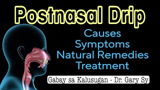 Postnasal Drip Causes Symptoms Natural Remedies amp Treatments  Dr Gary Sy [upl. by Avin]