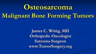 Orthopedic Oncology Course  Malignant Bone Forming Tumors Osteosarcoma  Lecture 4 [upl. by Furtek]