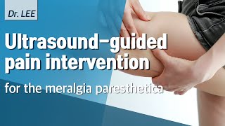 TAnatomy and US guided pain intervention for the meralgia paresthetica PRF treatement [upl. by Disario566]