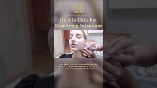 Fat Dissolving Injection For Double Chin Before and After [upl. by Kcinemod]