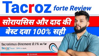 Tacroz Forte Ointment Review  Tacrolimus Ointment Uses Mode Of Action amp Side Effects In Hindi [upl. by Artined]