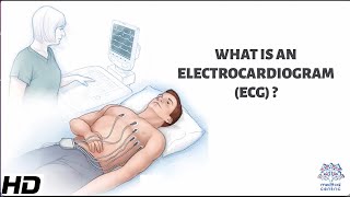 What Is An Electrocardiogram [upl. by Turtle563]