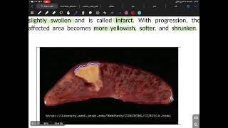 Patho lec1 cell injury part two [upl. by Ahter]