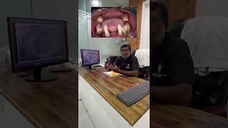 AA Sastha Dental Care and Mind Care  Understanding Aggressive Periodontitis dentalclinic [upl. by Nagah]