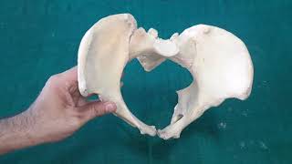 Osteology of Pelvis [upl. by Aenel]