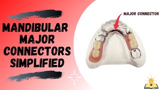 Mandibular Major Connectors  Removable Partial Denture RPD [upl. by Flip883]