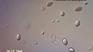 Time lapse of grape downy mildew pathogen Plasmopara viticola [upl. by Omura]