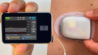 Omnipod 5 vs Tandem tslim x2  Full Test amp Review [upl. by Territus988]