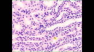 Simple cuboidal lining epithelium Kidney [upl. by Stephens]