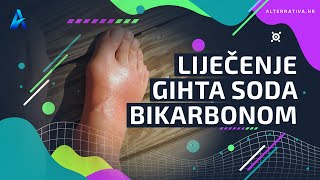 Liječenje gihta soda bikarbonom Alternativa hr [upl. by Nottarts735]