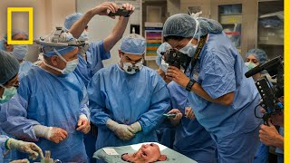 Youngest Face Transplant Recipient in US  National Geographic [upl. by Clari]