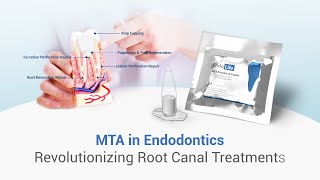 ROLE OF MTA IN ENDODONTICS dental dentalkart waldentMTA EndolifeMTA [upl. by France]