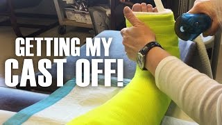 Getting My Cast Off  Broken Leg Fractured Fibula brokenleg cast [upl. by Halda]