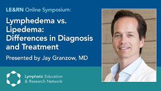 Lymphedema vs Lipedema Differences in Diagnosis and Treatment [upl. by Ursala92]