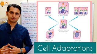 Cell adaptation pathology  Hyperplasia Hypertrophy Atrophy Metaplasia and Dysplasia [upl. by Birgitta863]