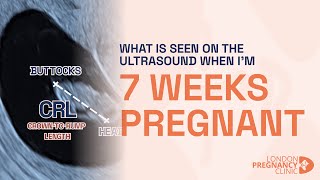 Week 7 Pregnant Ultrasound Babys Heartbeat amp Growth Shown [upl. by Allicsirp694]