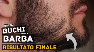 Buchi nella Barba Copenhagen Grooming TEST FINALE  Parte 4 [upl. by Hagi]