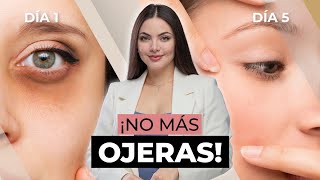 La guía definitiva para eliminar ojeras [upl. by Aliehs]