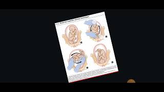 lec58 Obstratics LHV Diagnosis of Breech presentation الٹے بچے کی تشخیص کرنا [upl. by Silvie]