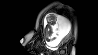 Foetal Development Unborn Baby Movement at 24 Weeks  WIRED [upl. by Glassco]