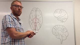 Arterial blood supply of the brain [upl. by Ellednahc]