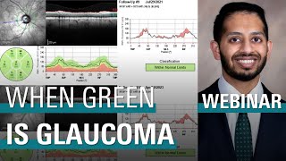 When Green is Glaucoma – OCT Pearls for Clinical Management of Glaucoma [upl. by Shirlee]