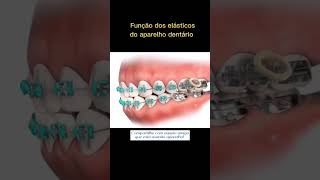 Elástico dos aparelhos ortodônticos dentista ortodontia [upl. by Sremmus597]