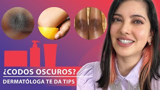 CODOS y RODILLAS percudidos tips para codos BONITOS [upl. by Assilim110]