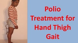 Polio Treatment for Hand Thigh Gait [upl. by Hawger]