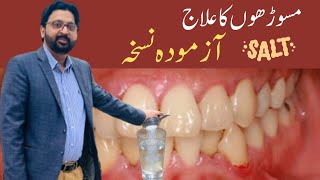 How to SWISH with SALT WATER to Cure Gum Disease Receding Gums and Gingivitis [upl. by Lanae760]